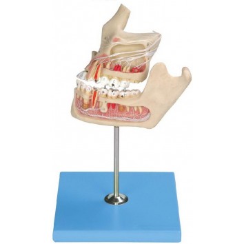 PATHOLOGIC TOOTH WITH JAW